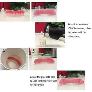 Denture Silicone Kit Silicone Liners Soft Kit Soft Denture Kit Teeth Upper And Lower Set Easy Use Dental care