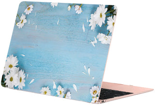 Case for Macbook Air 13 M4 M1 Pro 13 14 M5 M3 15 16 M2 Mac Hard Shell Funda A3240 A3113 A3241 A3434 Laptop Accessory Cover
