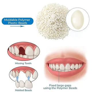 Moldable False Teeth, Tooth Repair Granules, Tooth Beads, Temporary Filling for Rooth, Broken Tooth Repair Kit, Thermal Fit Q6N2