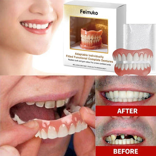 New Denture Silicone Kit - Soft Kit Teeth Upper And Lower Set - Silicone Liners Soft Denture Kit - Easy Use