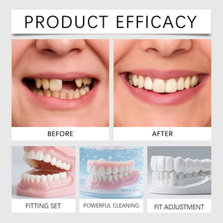 New Denture Silicone Kit - Soft Kit Teeth Upper And Lower Set - Silicone Liners Soft Denture Kit - Easy Use