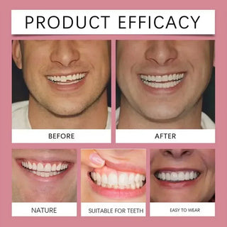 False Teeth Silicone Upper Lower Veneers Perfect Laugh Veneers Dentures Paste Fake Teeth Braces Comfortable Teeth Orthodontic
