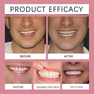 False Teeth Silicone Upper Lower Veneers Perfect Laugh Veneers Dentures Paste Fake Teeth Braces Comfortable Teeth Orthodontic